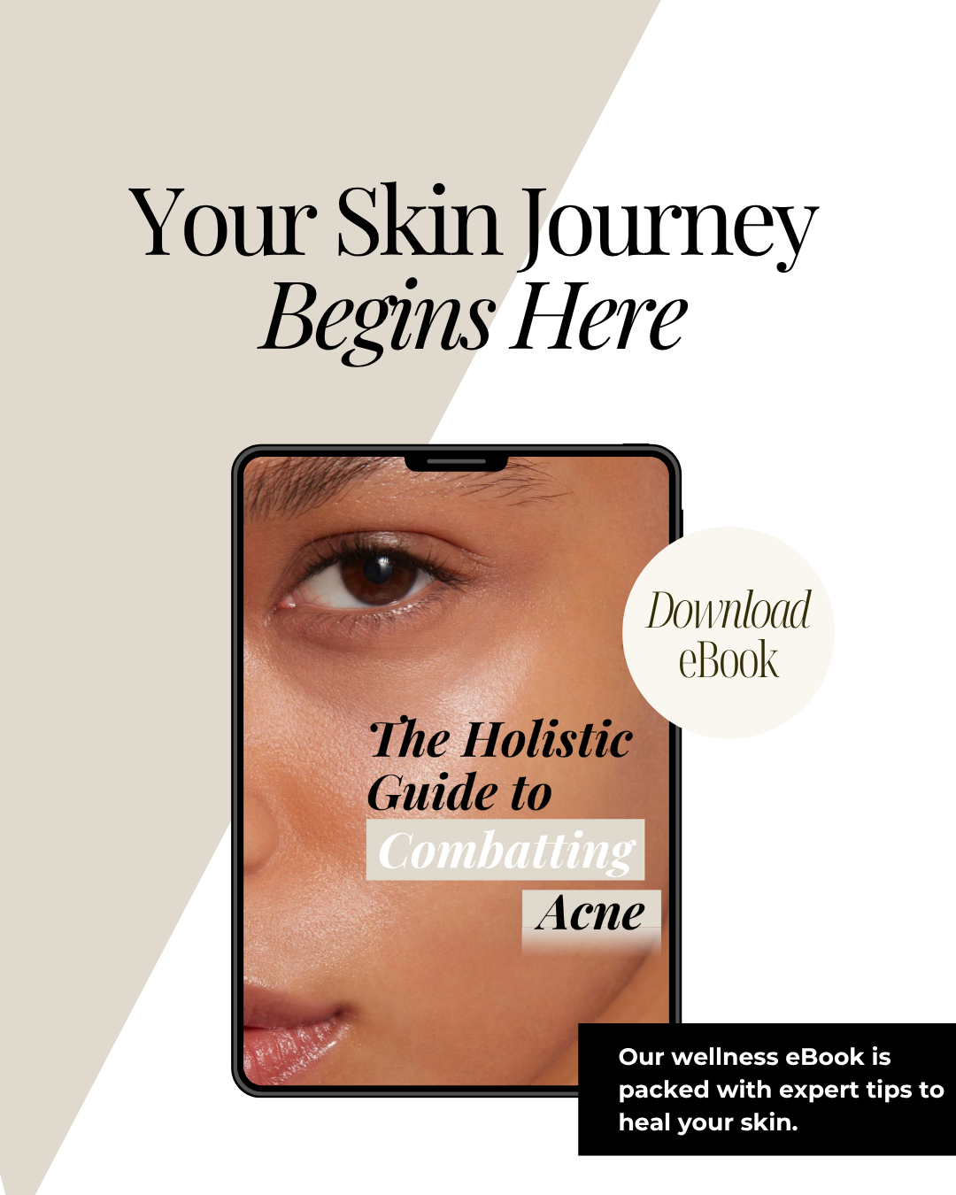 Holistic Guide to Combatting Acne eBook