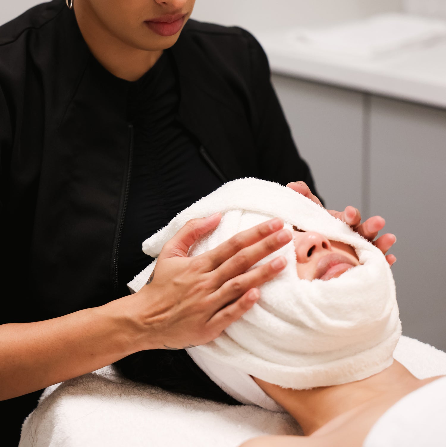 microneedling experiences