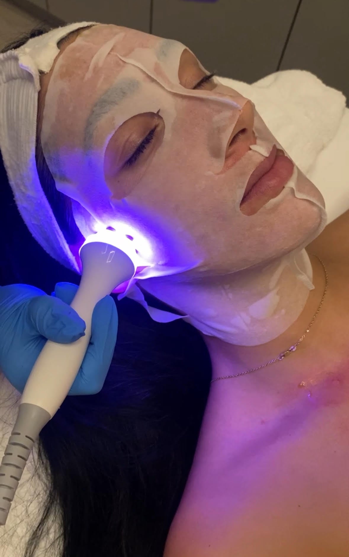 ADVANCED MICRONEEDLING WITH VITAMIN INFUSION BENIFITS
