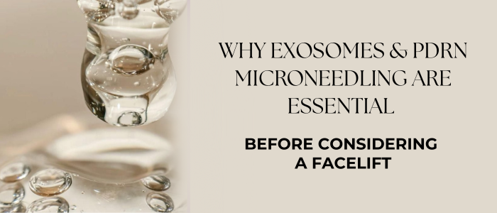 Why Exosomes and PDRN Microneedling Are Essential Before Considering a Facelift