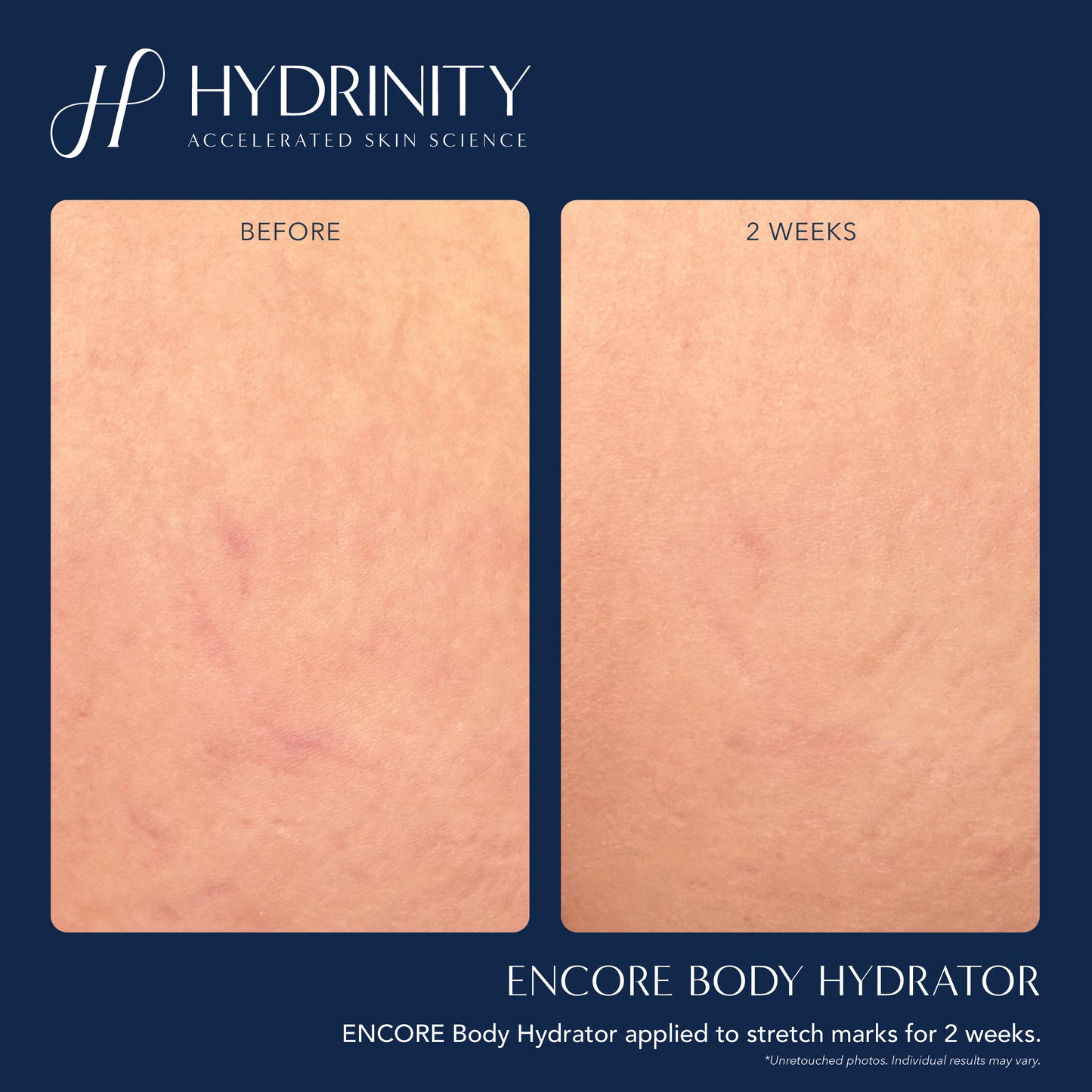 Encore Body Hydrator 208ml