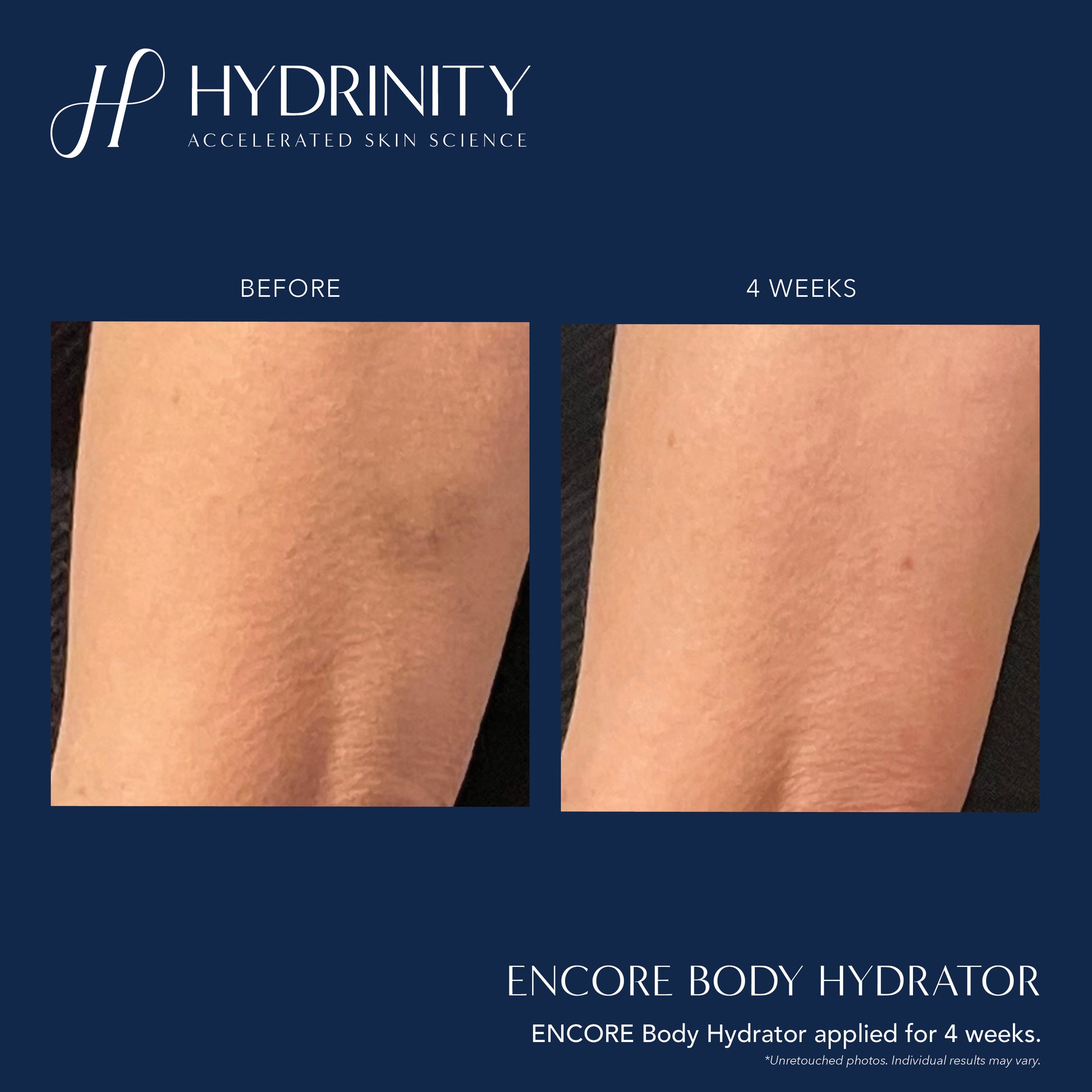 Encore Body Hydrator 208ml