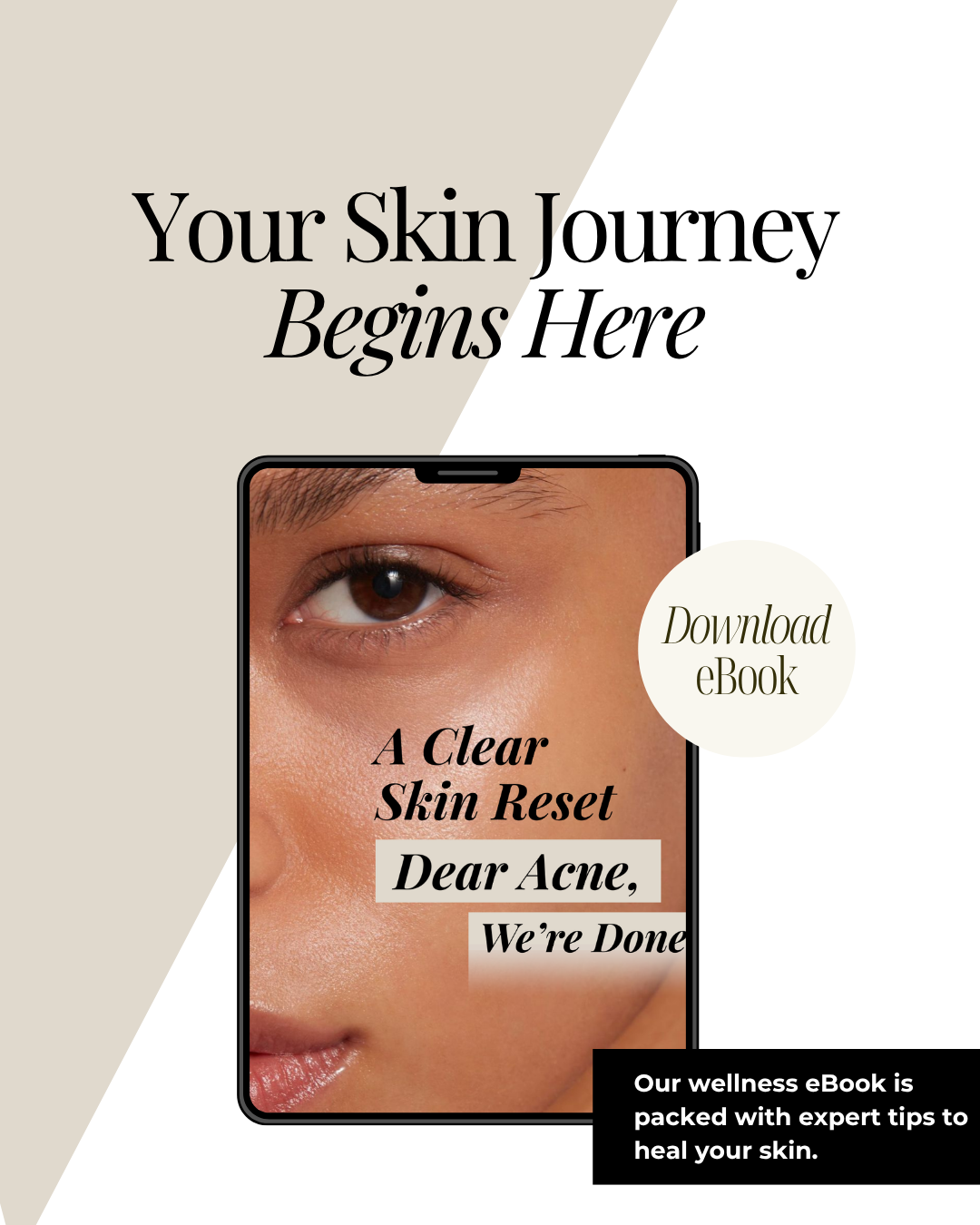 A Clear Skin Reset: Dear Acne, We're Done eBook