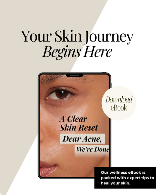 Clear Skin Reset Acne ebook digital download