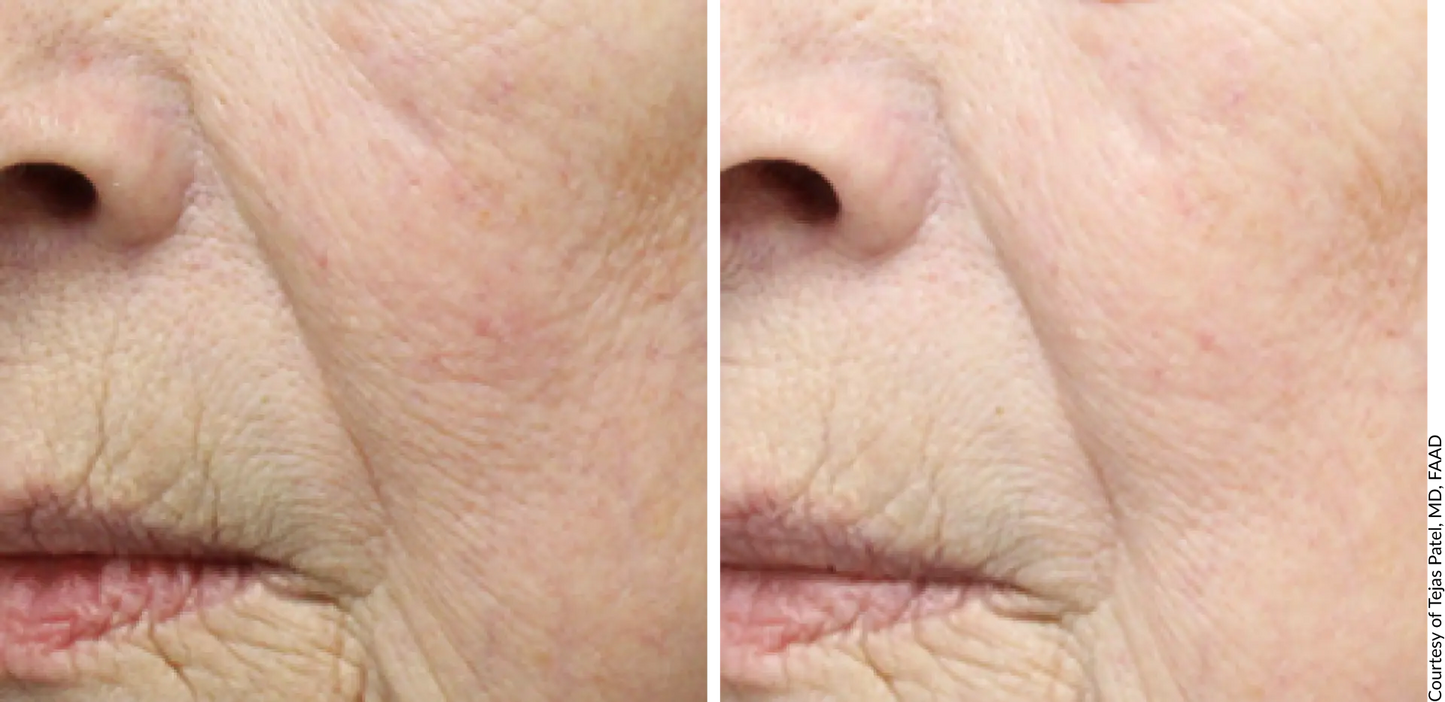 DE|RIVE Age Defying Serum