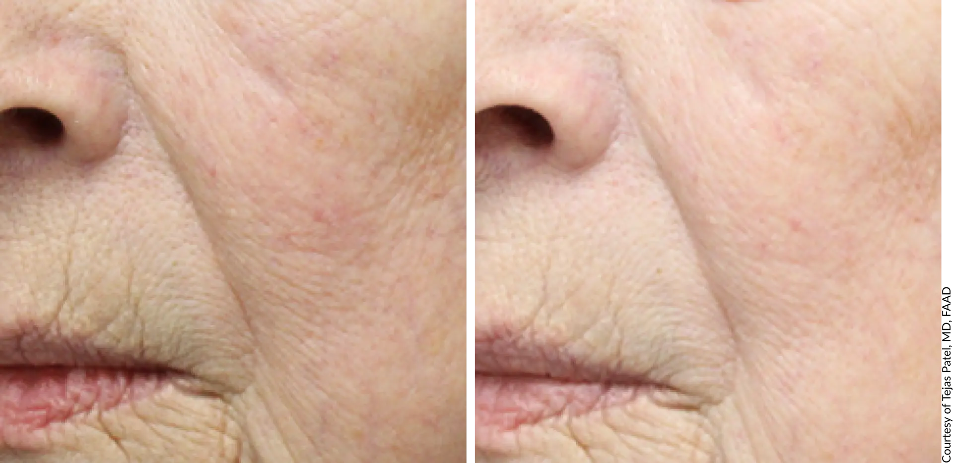 DE|RIVE Age Defying Serum