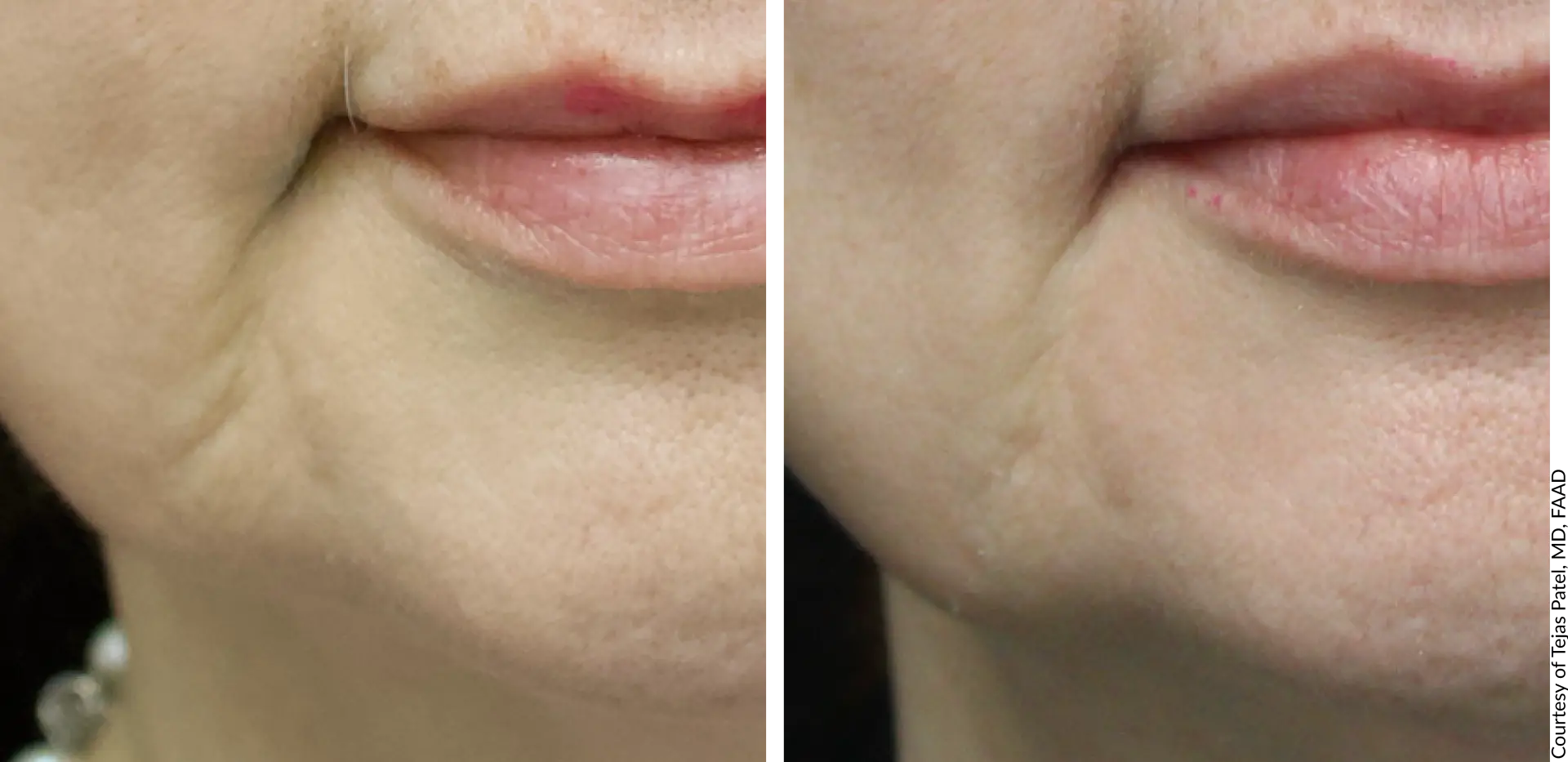 DE|RIVE Age Defying Serum